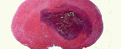 <a href='/'>出國看病</a>，<a href='/'>海外醫(yī)療</a>，厚樸方舟