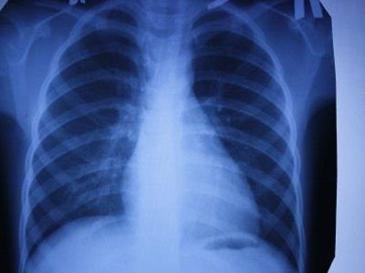 <a href='/'>出國(guó)看病</a>，<a href='/japan/'>日本看病</a>，厚樸方舟