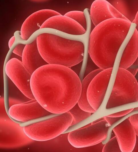 美國(guó)看病,美國(guó)白血病