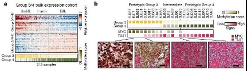 髓母細(xì)胞瘤基因表達(dá)特征