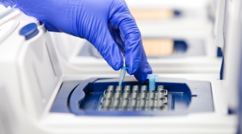 出國看病:研究發(fā)現(xiàn)癌癥免疫治療方法方法新靶點(diǎn)