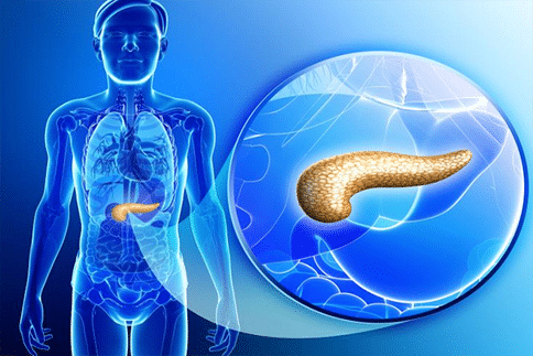 抑制名為“Yap”的生物網(wǎng)絡(luò)或能有效抑制早期PDAC的發(fā)生