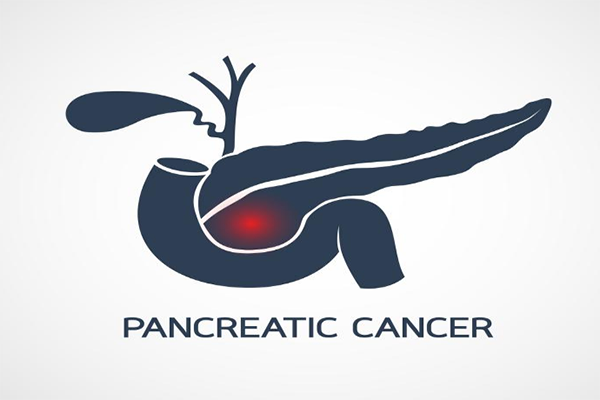 胰腺導(dǎo)管腺癌是胰腺癌的病理類型