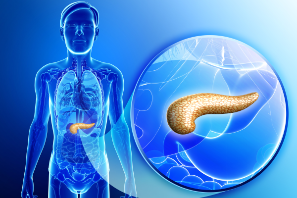 癌癥出國治療：新研究揭示胰腺癌如何生長，或為胰腺癌治療提供新方向