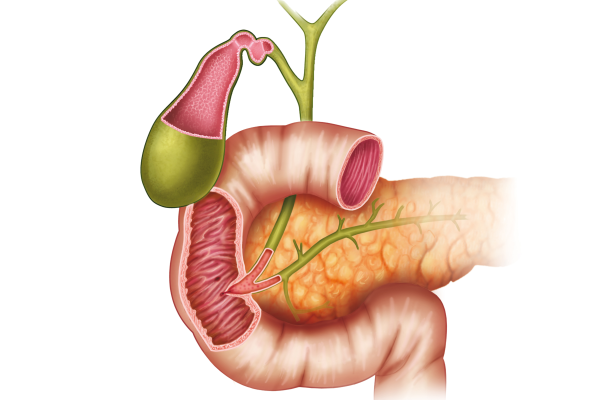 出國(guó)看?。篢PPP可能是治療胰腺癌的新靶標(biāo)，可抑制胰腺癌的發(fā)展