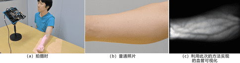 出國看病：日本開發(fā)出一種新技能可以輕松確認(rèn)患者的血管