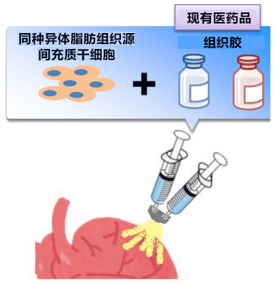 日本開發(fā)出一種治療心力衰竭的新技能，目前已進行臨床試驗！