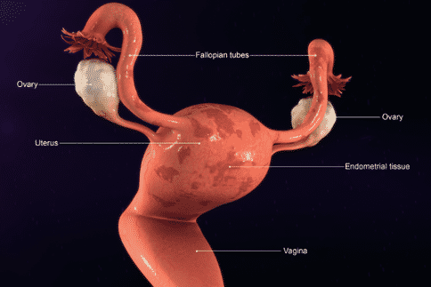 子宮肌瘤的癥狀