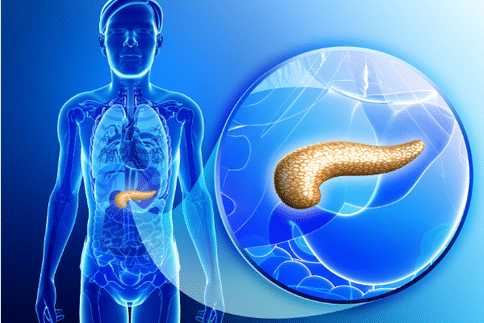 日本胰腺癌治療