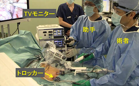 日本腹腔鏡手術治療直腸癌