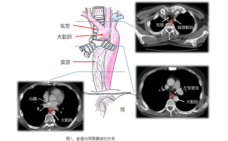 食道癌治療醫(yī)院