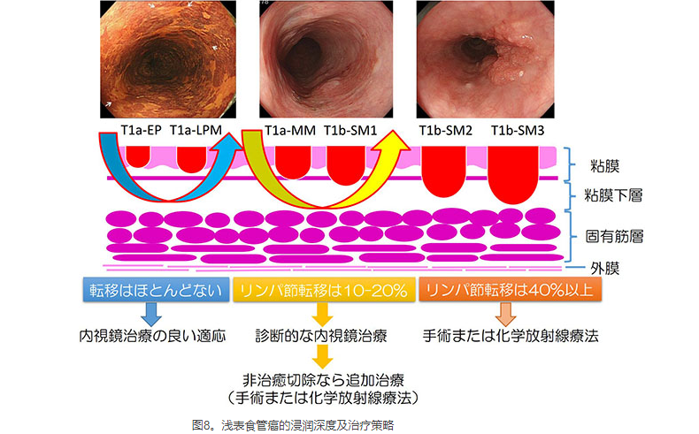 日本食道癌醫(yī)院