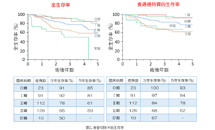 癌研有明醫(yī)院治療食道癌
