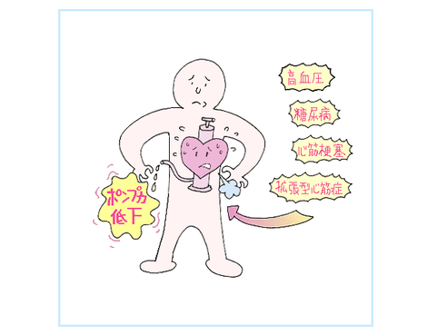 日本治療心力衰竭 日本治療心力衰竭