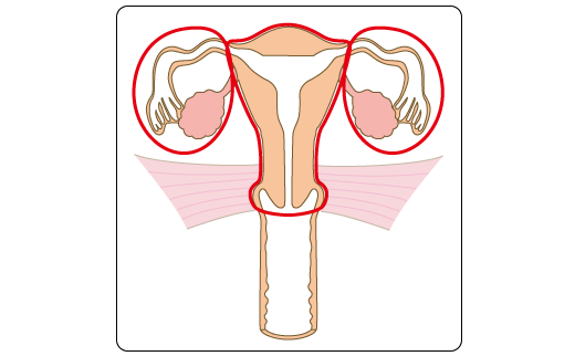 日本治療子宮癌前沿方法 日本治療子宮癌前沿方法