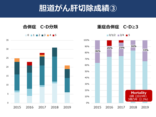 日本癌研有明醫(yī)院治療膽管癌