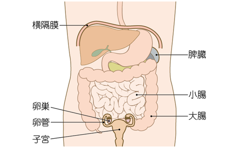 日本卵巢癌治療方法