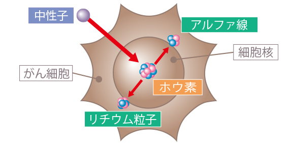硼中子俘獲治療 硼中子俘獲治療