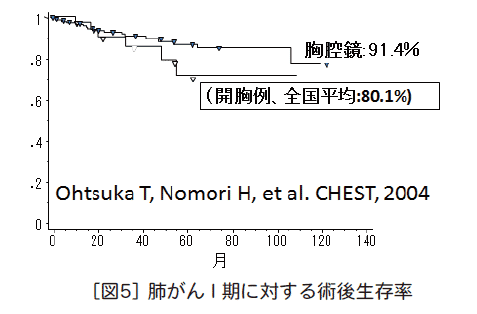 一期肺癌的胸腔鏡手術(shù)、開胸手術(shù)生存率對比