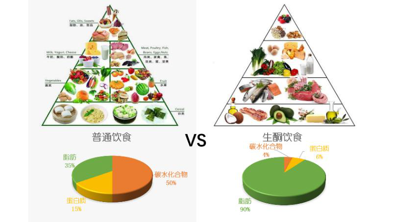 日本治療癲癇