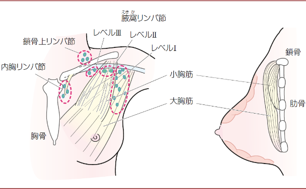 日本乳腺癌治療 日本乳腺癌治療