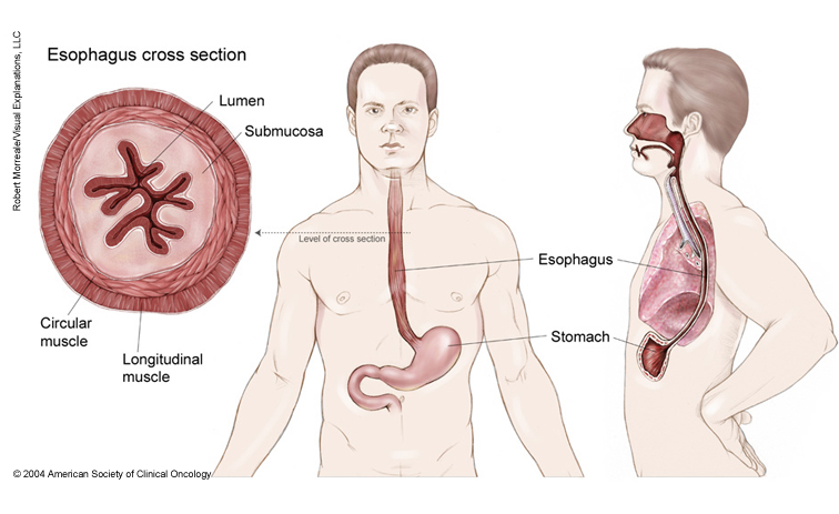 食道癌是怎么引起的