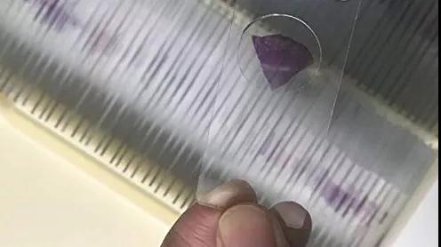 病理診斷