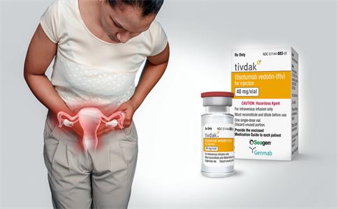 Tivdak治療難治性宮頸癌，總緩解率提高62.5%